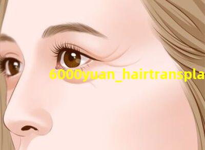 6000元植发效果图