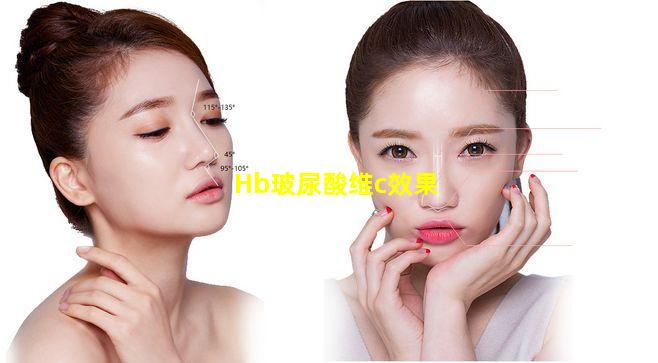 Hb玻尿酸维c效果