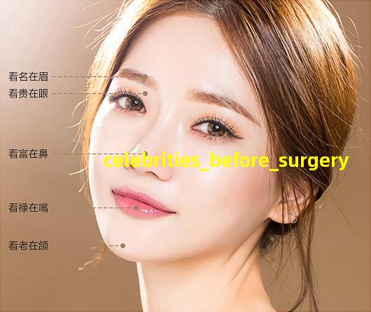 celebrities before surgery