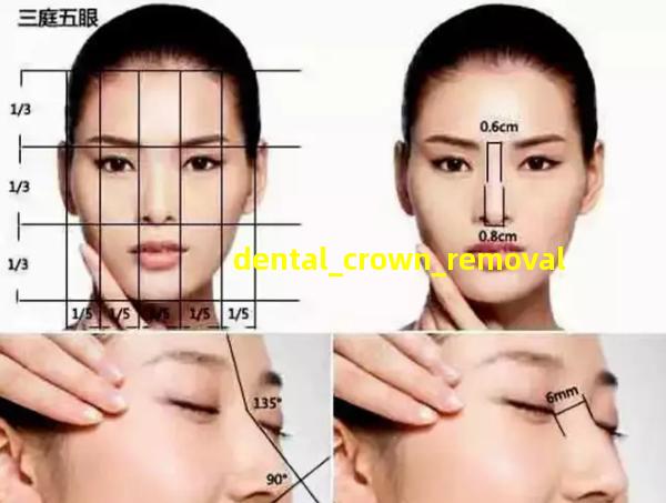 dental crown removal