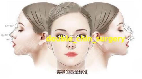 double chin surgery