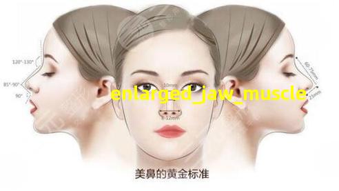 咬肌肥大图片