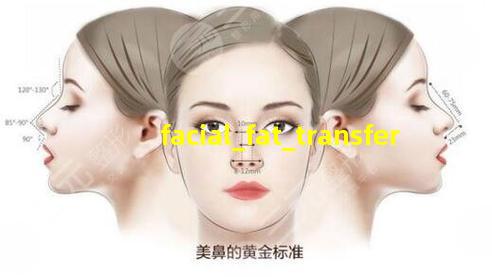 自体脂肪填充法令纹的示意图