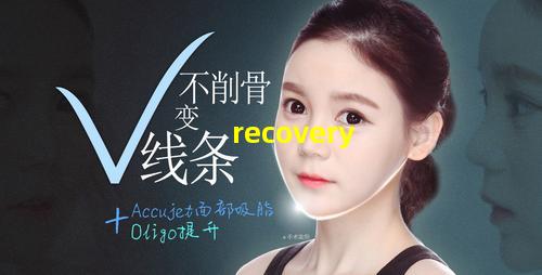割眼袋恢复图