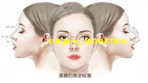 手术吸脂图片