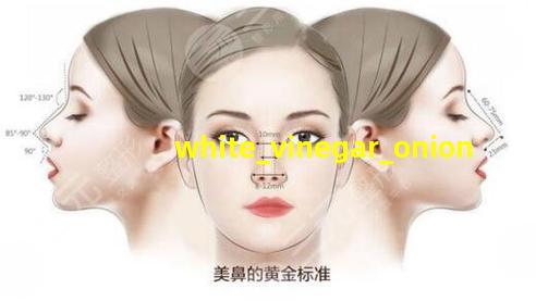 白醋泡洋葱祛斑方法