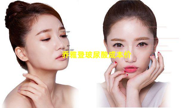 乔雅登玻尿酸成本价