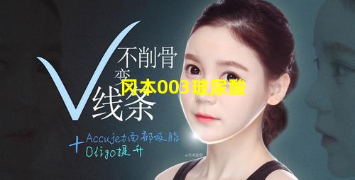 冈本003玻尿酸