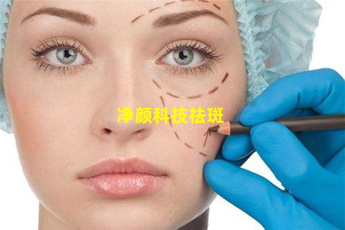 净颜科技祛斑