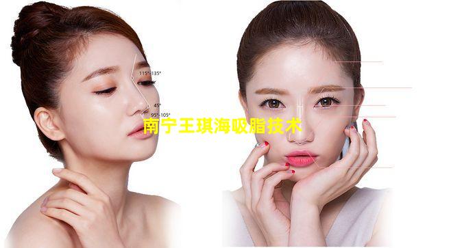 南宁王琪海吸脂技术