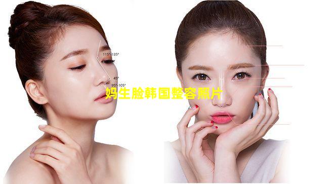 妈生脸韩国整容照片