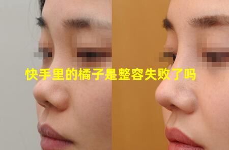 快手里的橘子是整容失败了吗