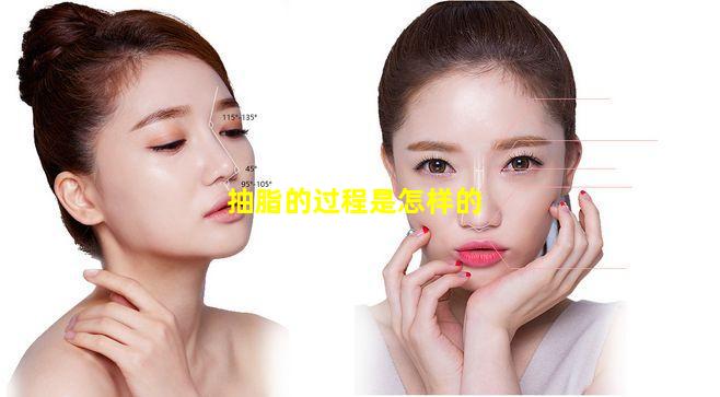 抽脂的过程是怎样的