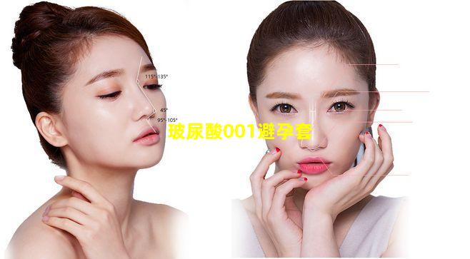 玻尿酸001避孕套