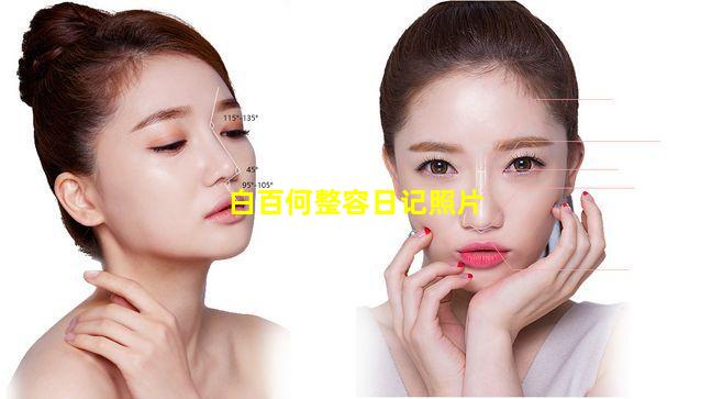 白百何整容日记照片